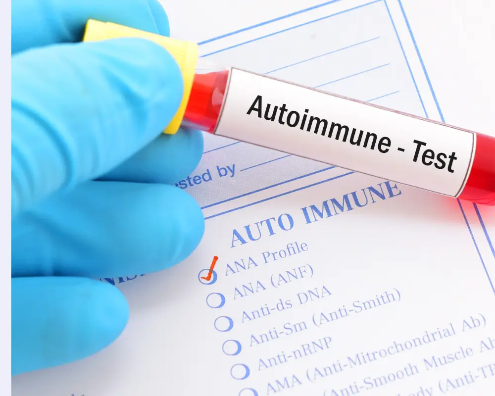 autoimmune